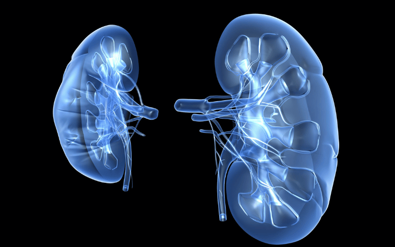 Kidney Disorders An Unforeseen Link to Myeloma's Onset