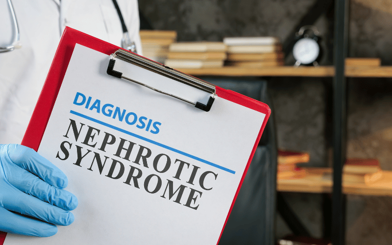 Nephrotic Syndrome The Protein Drain