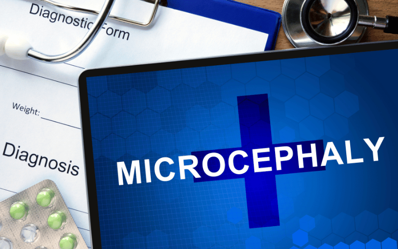 Microcephaly - The Silent Tale of a Smaller Brain