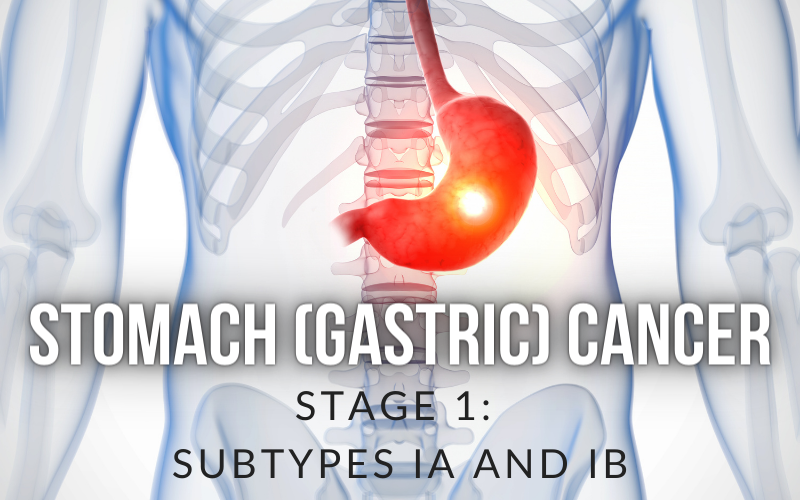 The Diverging Paths Stage I Gastric Cancer