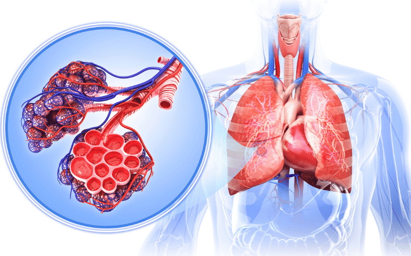 Respiratory Distress LCH’s Stealthy Stranglehold on the Lungs