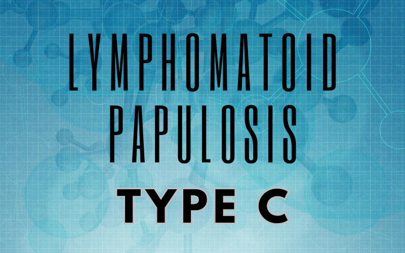 Nodular Narratives Delving into Type C