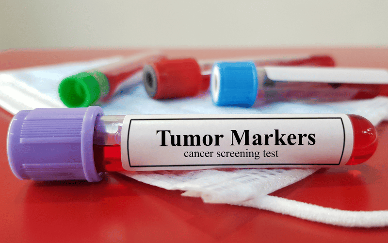 The Crucial Clock How Early Detection Influences CTCL's Prognosis