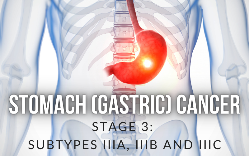 The Critical Juncture Stage III Gastric Cancer