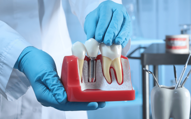 Dental Materials The Oral Connection to Lichen Planus