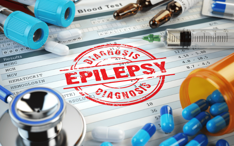 The Therapeutic Landscape Managing Myoclonic Epilepsy