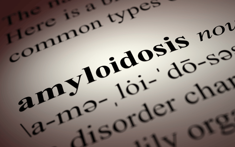 Light Chain Amyloidosis The Unintended Consequences of Protein Build-up