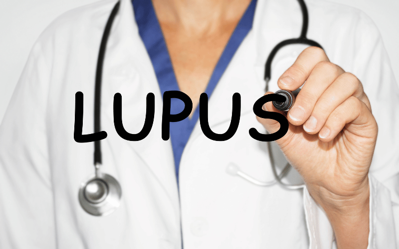 Lupus The Autoimmune Wild Card