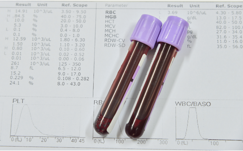 A Fluid Battle Monitoring Blood Count Dynamics in HCL