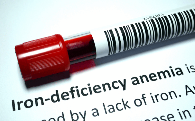 Iron-Deficiency Anemia The Silent Sapper of Strength