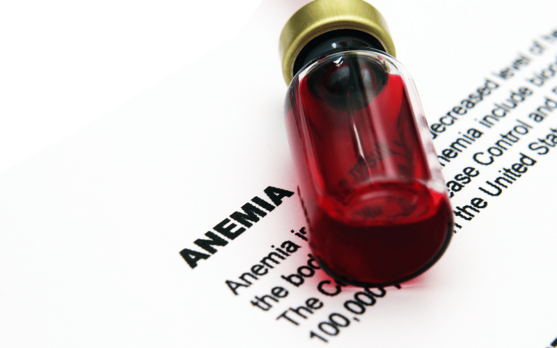 Anemia The Invisible Energy Drain