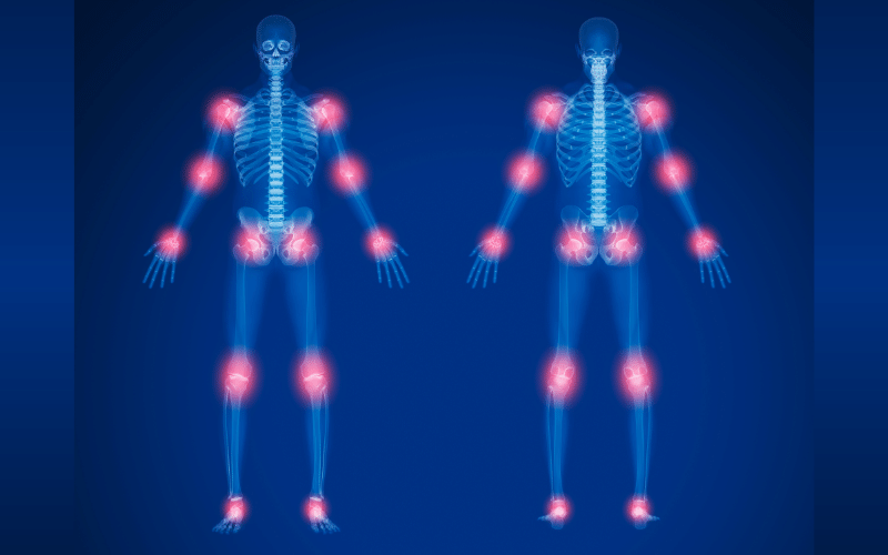 The Enigma of Sjögren's and Joint Pain An Unexpected Partnership