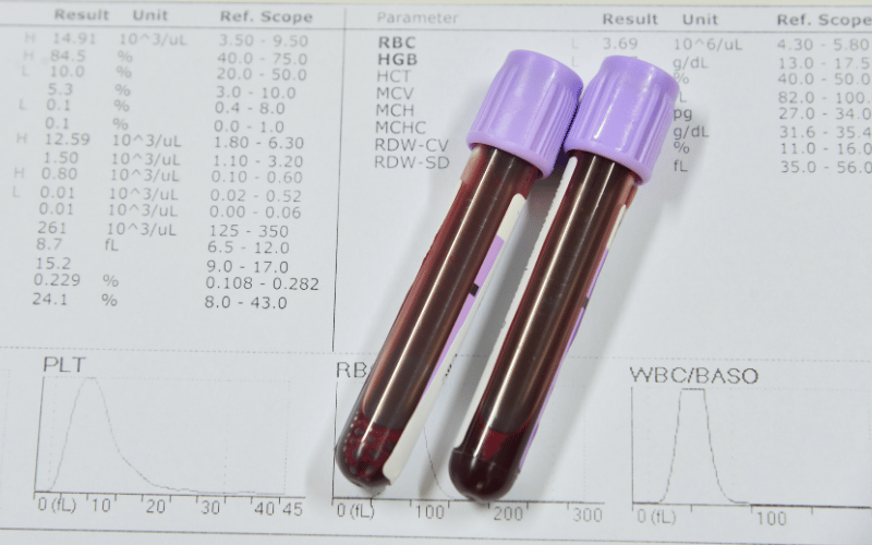 Abnormal Blood Counts The Invisible yet Revealing Markers