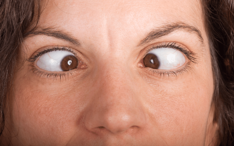 Abnormal Eye Movements The Window to Gaucher