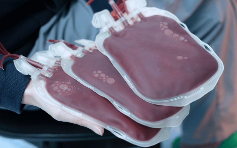 Blood Transfusions and HCV – A Retrospective