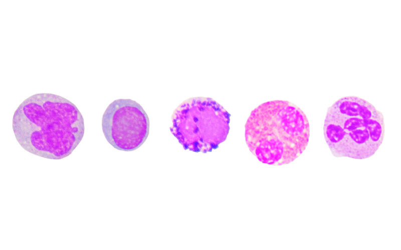 Defining Monoclonal Gammopathy