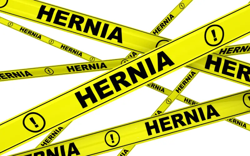 Definition of A Femoral Hernia