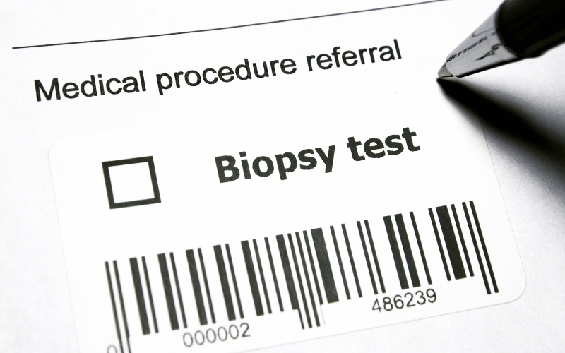 Diagnosing Burkitt Lymphoma