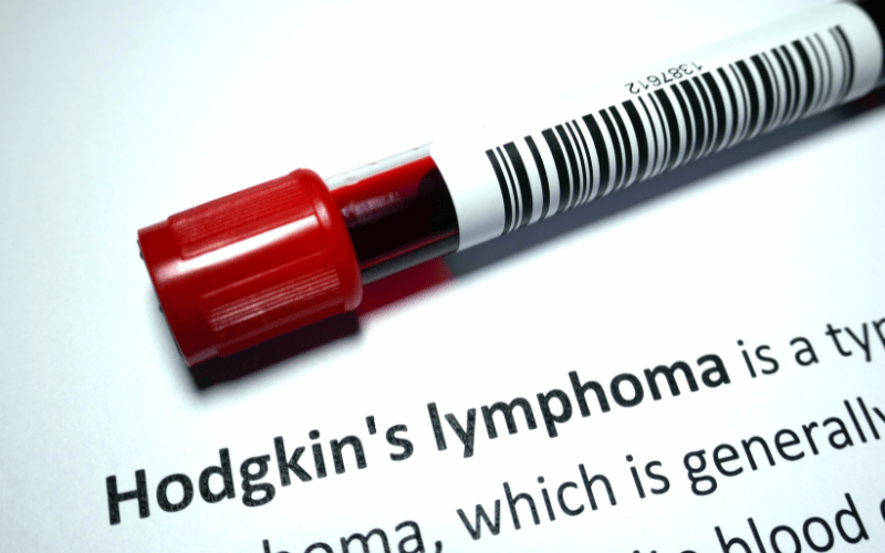 Frequently Asked Questions about Hodgkin's Lymphoma