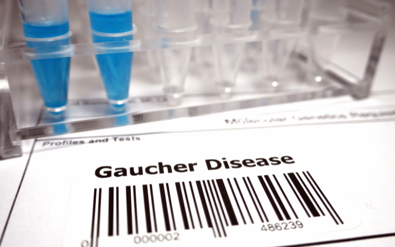 Gaucher's Disease - A Lysosomal Storage Disorder