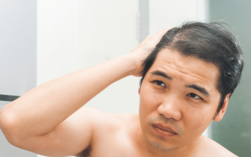Hair Loss The Unsettling Cosmetic Concern