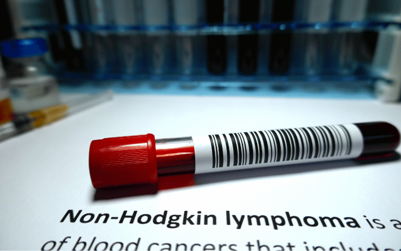 It's a Type of Non-Hodgkin Lymphoma