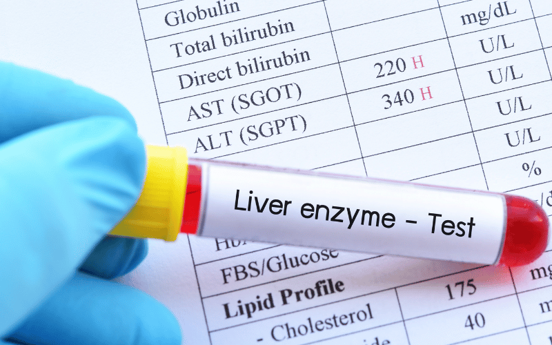 Liver Enzyme Abnormalities