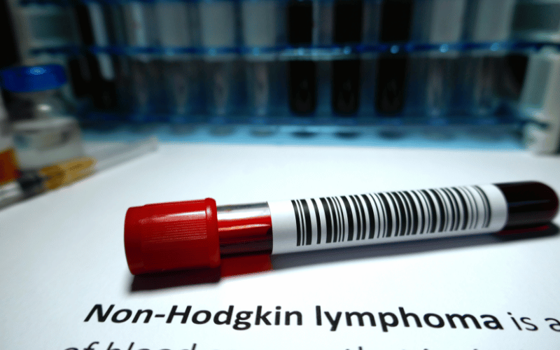 Mantle Cell Lymphoma