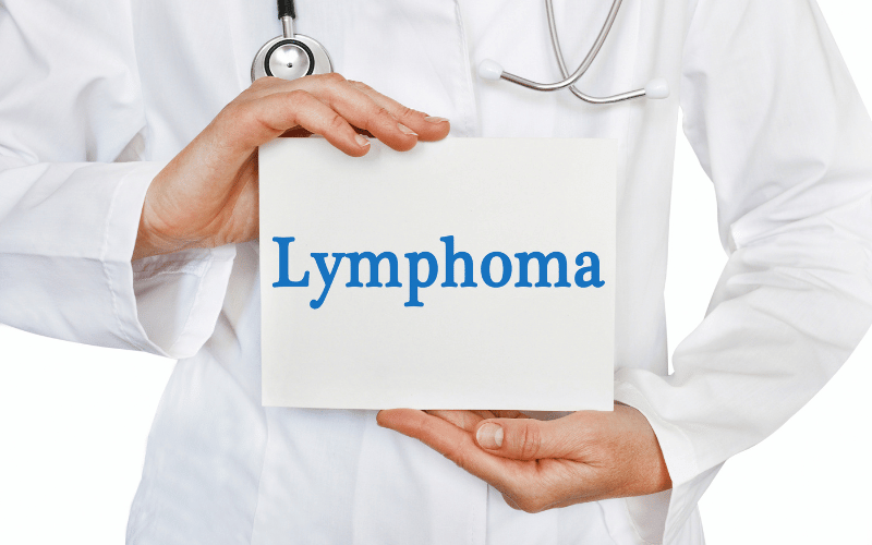 Navigating the Complex Landscape of Burkitt Lymphoma Life Expectancy