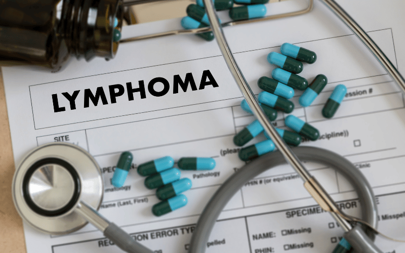 Rare Progression to More Serious Lymphomas