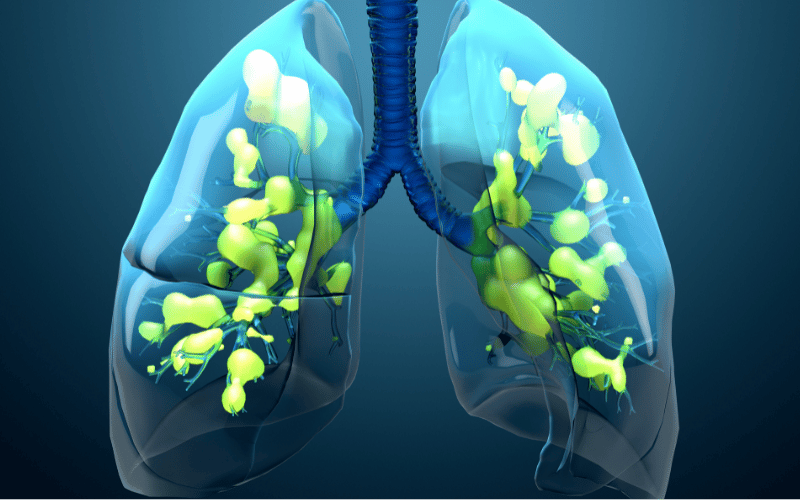 Respiratory Distress