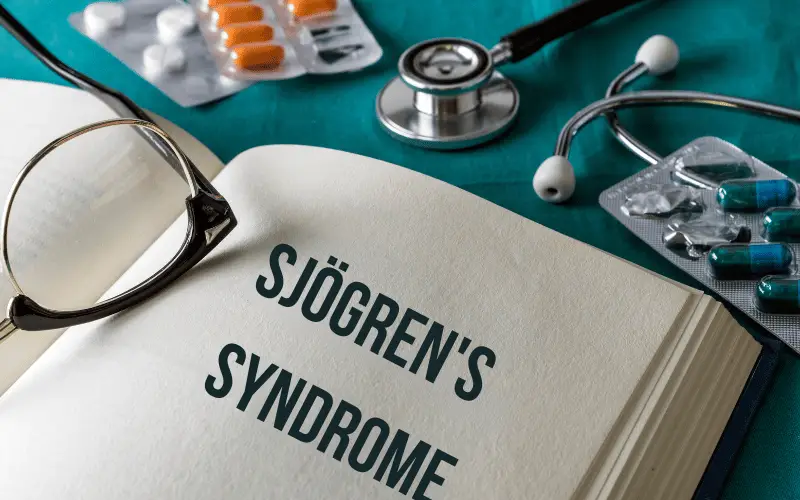 Sjögren's Syndrome 101 15 Key Takeaways and Facts