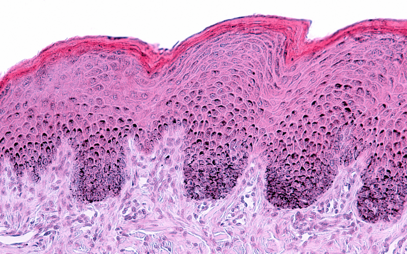 Skin Problems and Discoloration