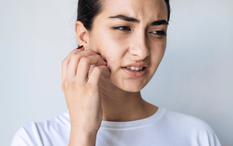 Skin Rash The Unexpected Outbreak in Mononucleosis