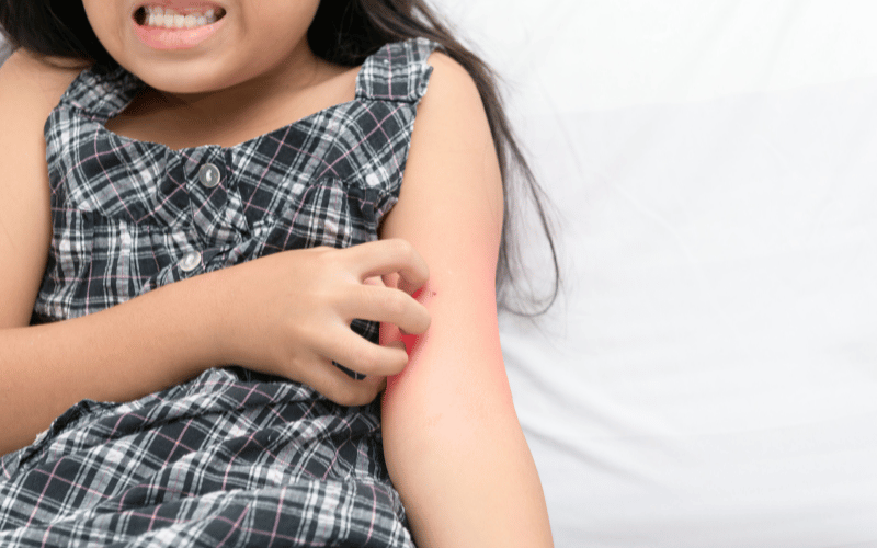 Skin Rash or Itching An Irritation That Won't Resolve