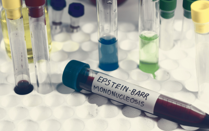 The Epstein-Barr Virus Link