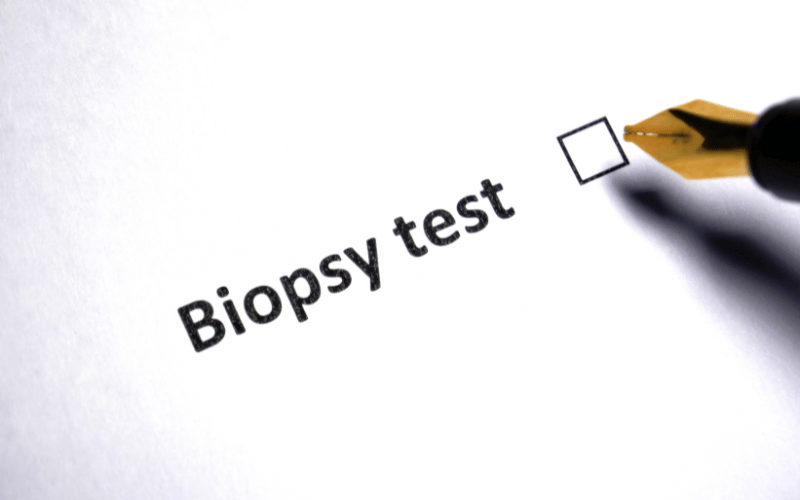 The Role of Biopsy in Diagnosis