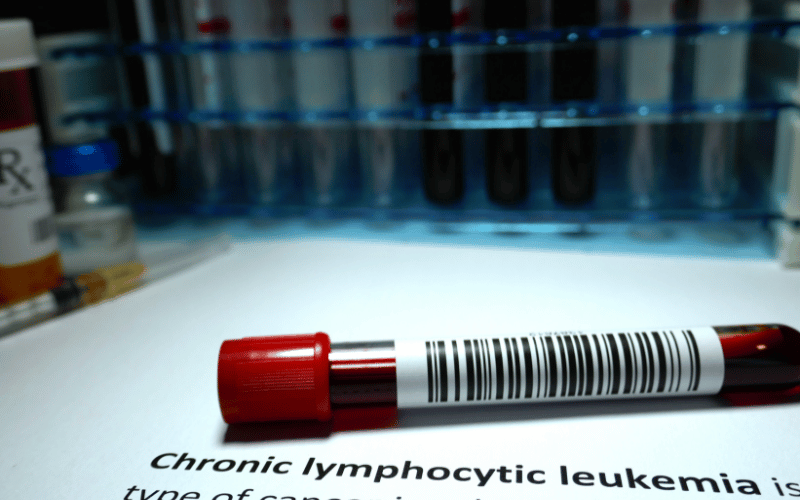 The Silent Predator Known as Chronic Lymphocytic Leukemia