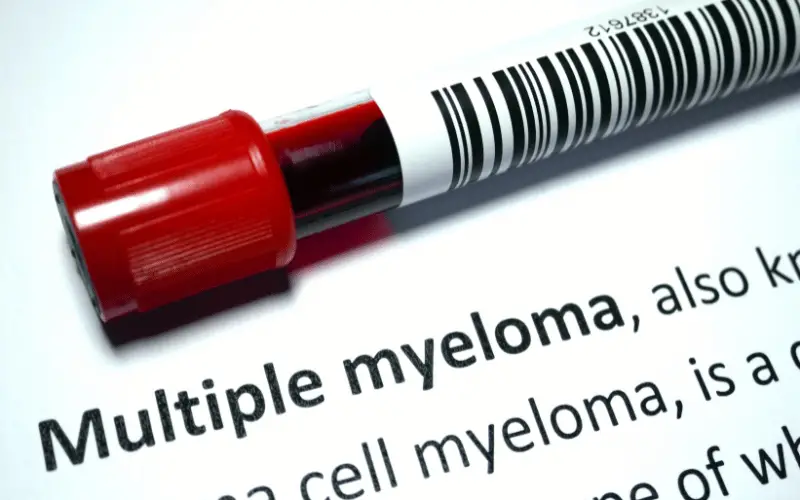 Understanding Multiple Myeloma