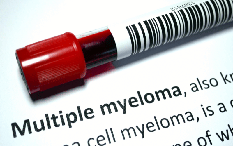 10 Essential Facts About Multiple Myeloma Life Expectancy: Everything ...