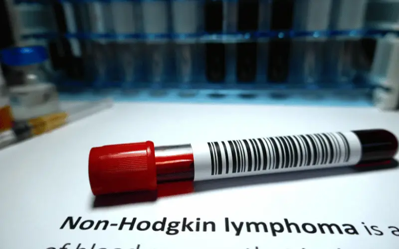 Understanding the Two Predominant Types of Non-Hodgkin's Lymphoma