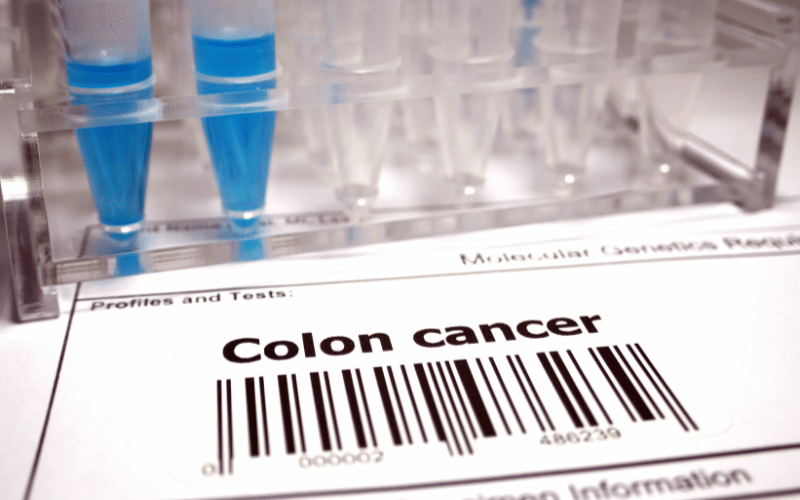 Ten Symptoms that Ring Alarm Bells Identifying Stage 2 Colorectal Cancer