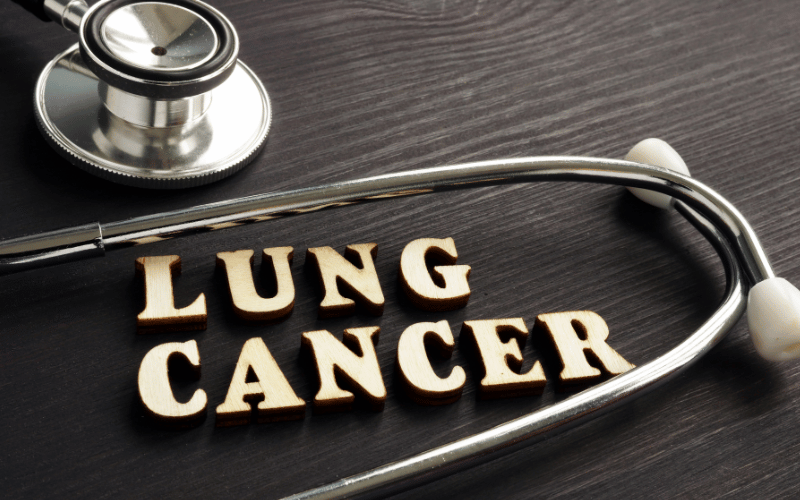 10 Factors that Influence Your Lung Cancer Prognosis An Informed Perspective