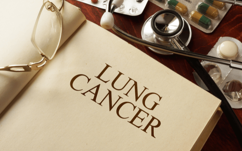 4 Types of Lung Carcinoma A Look into the Most Common Variants