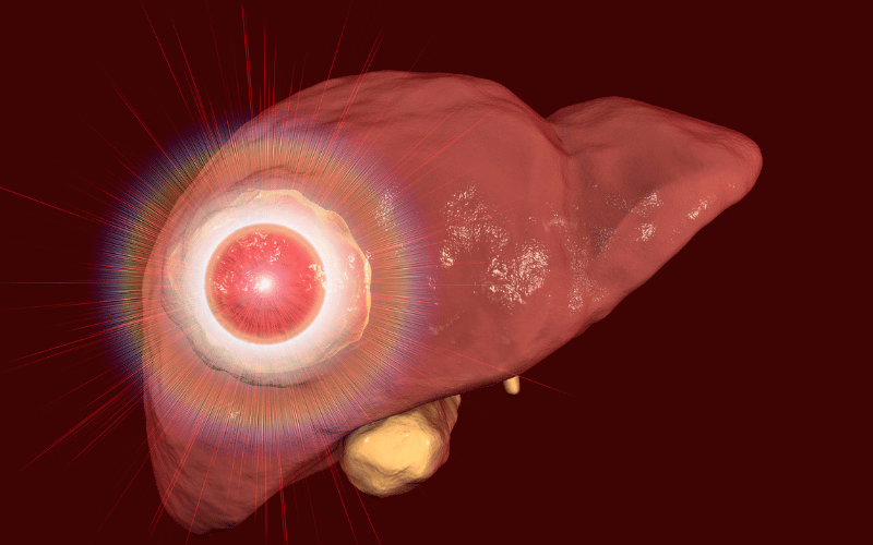 FNH for the Non-Medical 10 Symptoms Decoded