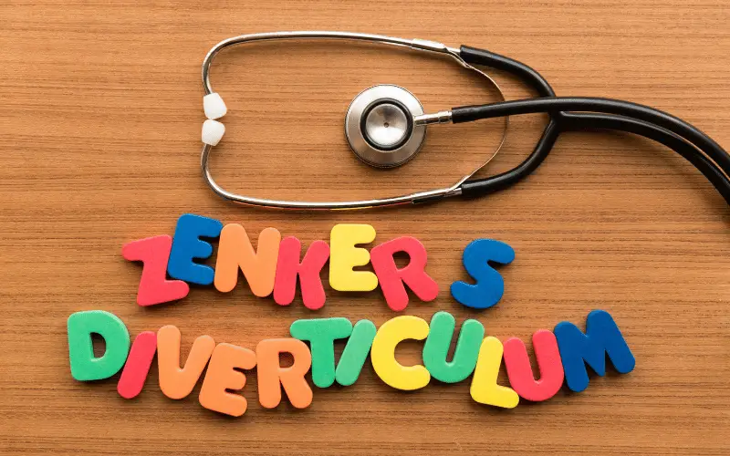 How to Detect Zenker's Diverticulum 10 Symptoms That Stand Out