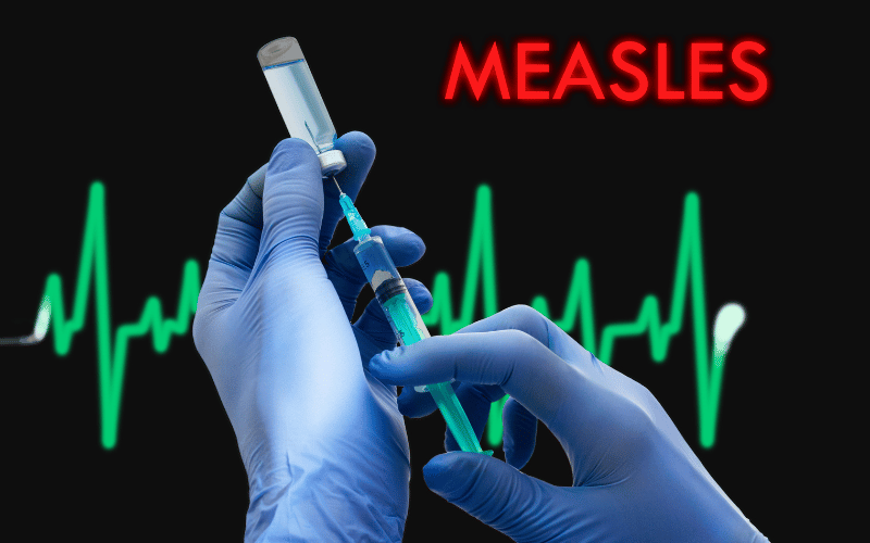 Top 10 Facts to Fortify You Against Measles Threats