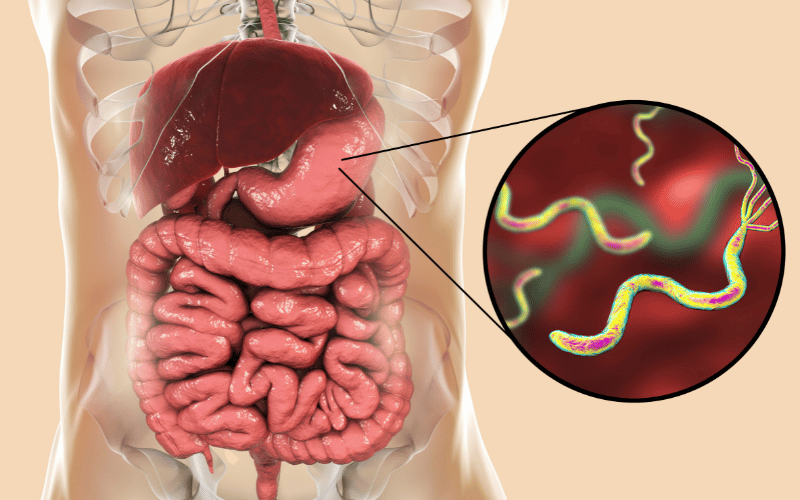 H. Pylori Infections A Microscopic Menace Within