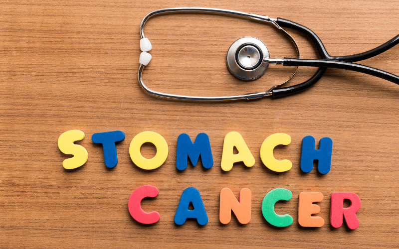 10 Causes of Stomach Cancer (Gastric Cancer) You Should Know