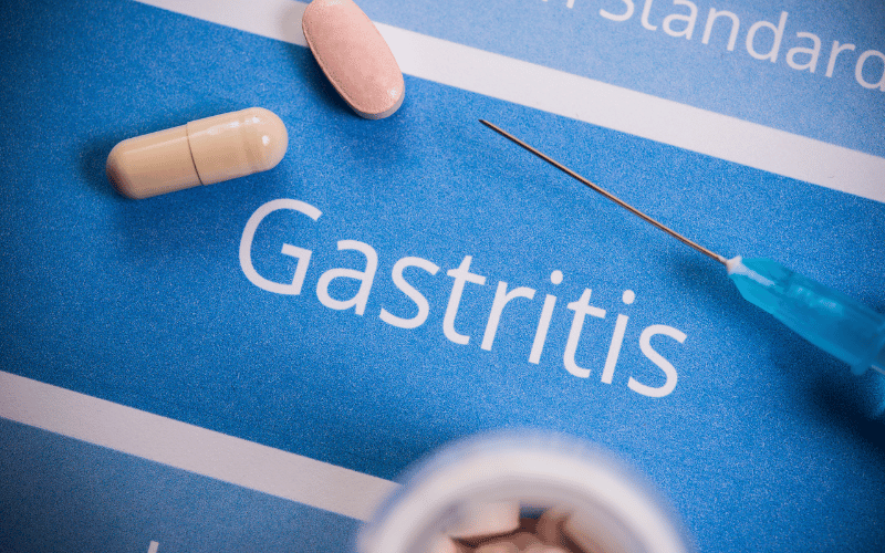 10 Critical Facts You Need to Know About Gastritis Prognosis